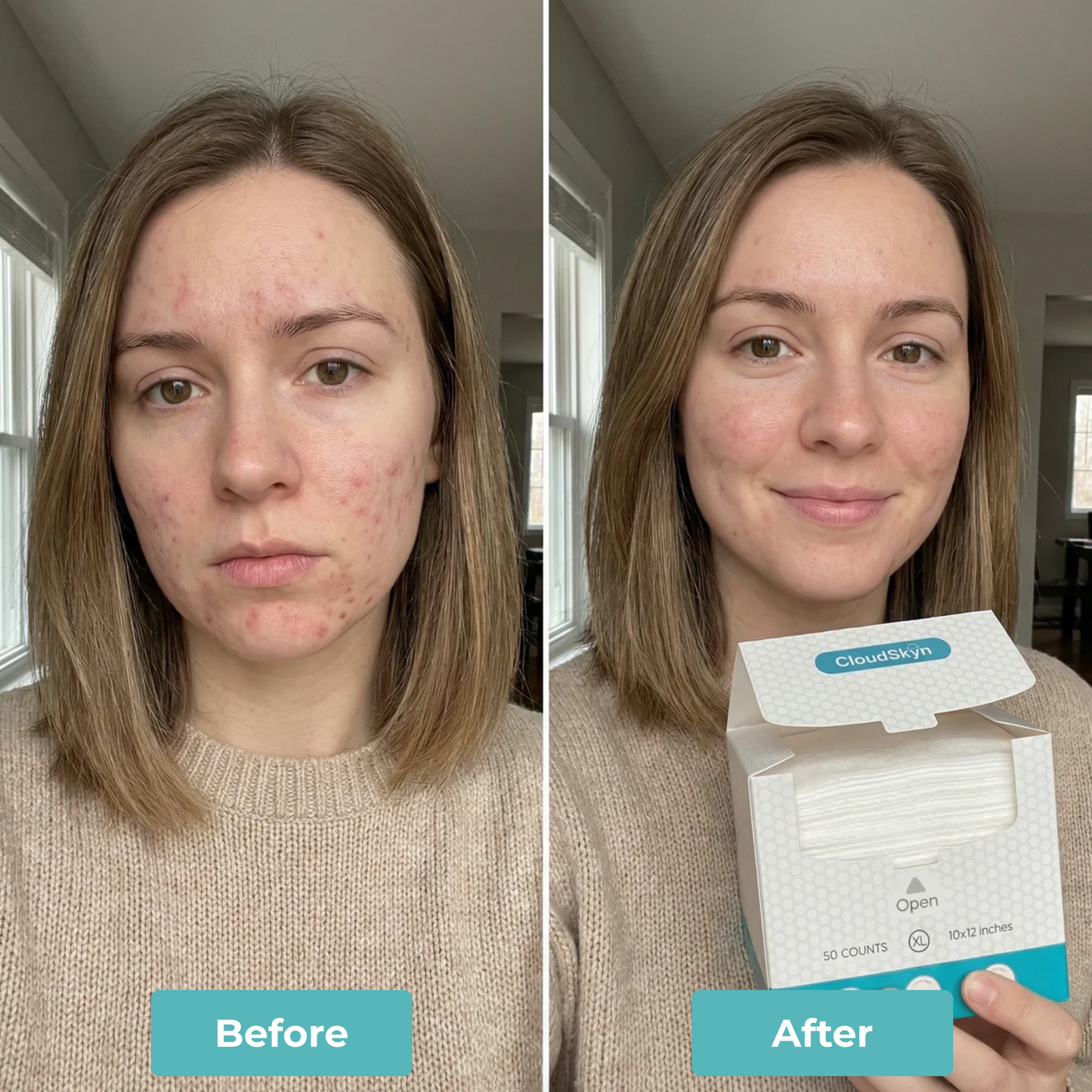 CloudSkyn™ Fresh Face Towels