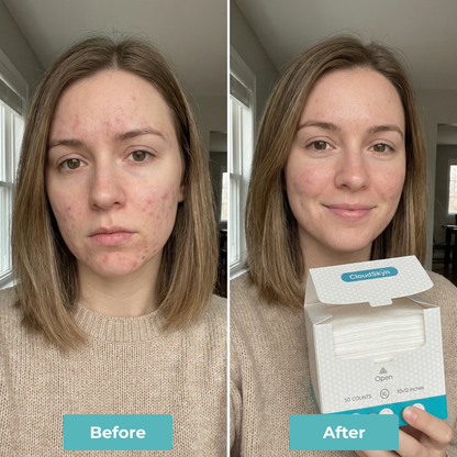 CloudSkyn™ Fresh Face Towels